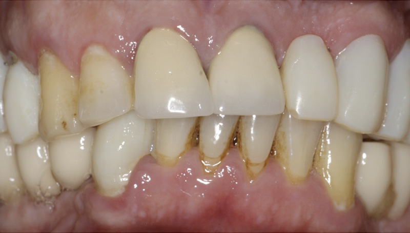 Clinical case 4683