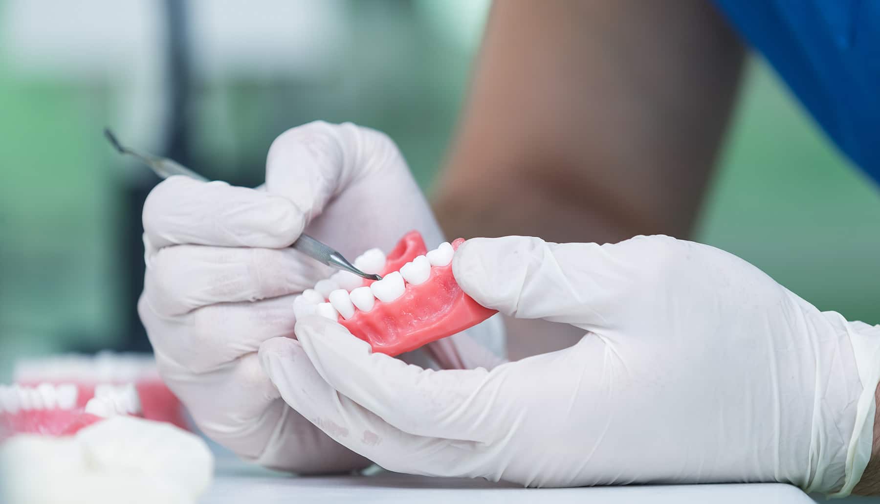 Prosthodontics Dental Progress Bucuresti Dorobanti