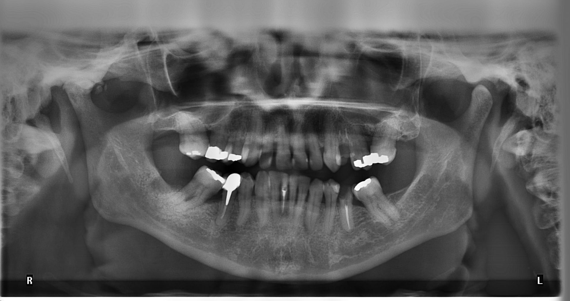 Radiografia dentara